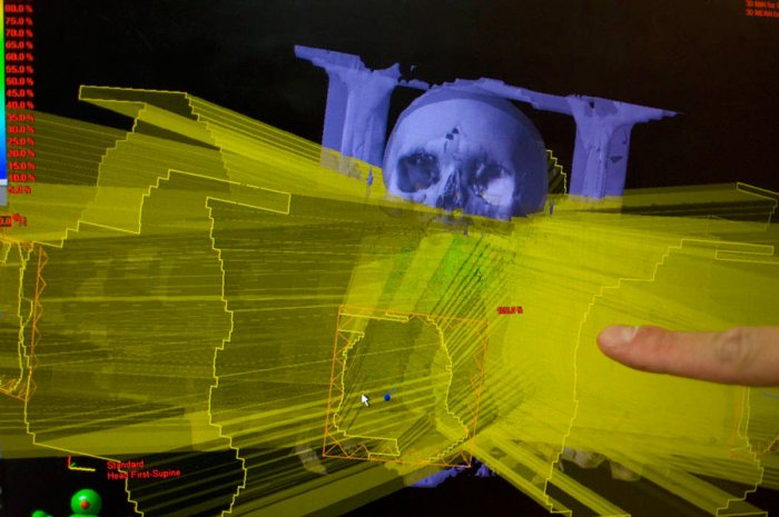 Exploring Cancer - Test of Dosimetry