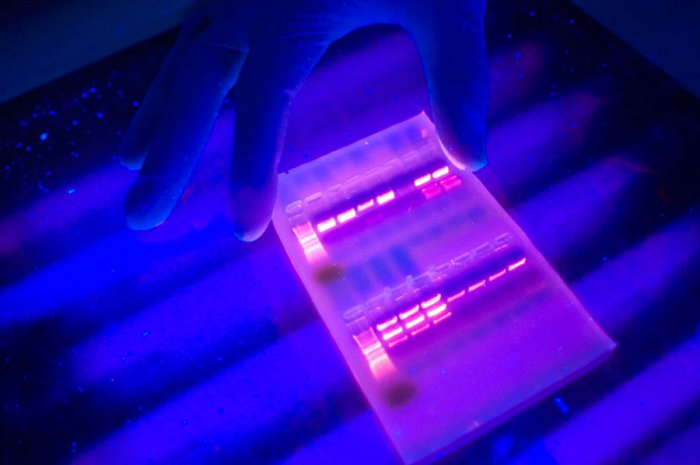 Exploring Cancer - Electrophoresis gel